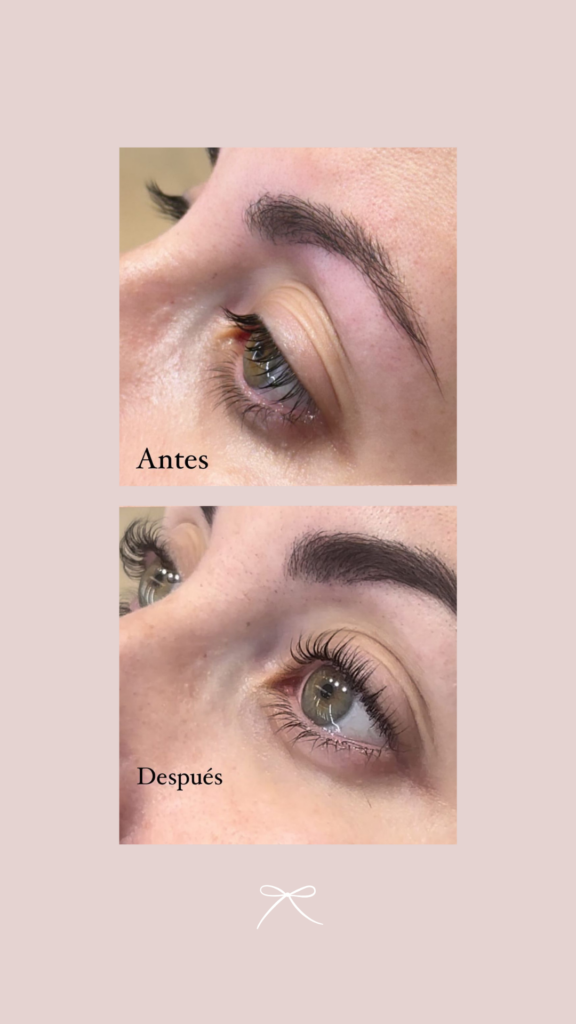 antes-despues-diseño-cejas